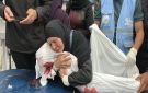استشهاد طفل فلسطيني متأثرا بإصابته برصاص العدو الإسرائيلي شمال غزة