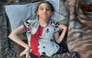 بين العمى والشلل الرباعي.. خيمة متهالكة تختزل مأساة عائلة في غزة