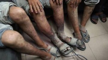 وزارة الأسرى بغزة تحذر من خطورة تفشي مرض الجرب بين أسرى سجن النقب وزارة الأسرى بغزة تحذر من خطورة تفشي مرض الجرب بين أسرى سجن النقب