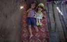 صحة غزة: 5 آلاف حالة بتر و10 آلاف بحاجة لتأهيل طويل الأمد